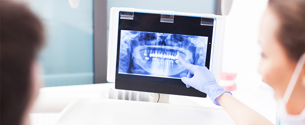 Profesional mostrando radiografía digital a paciente